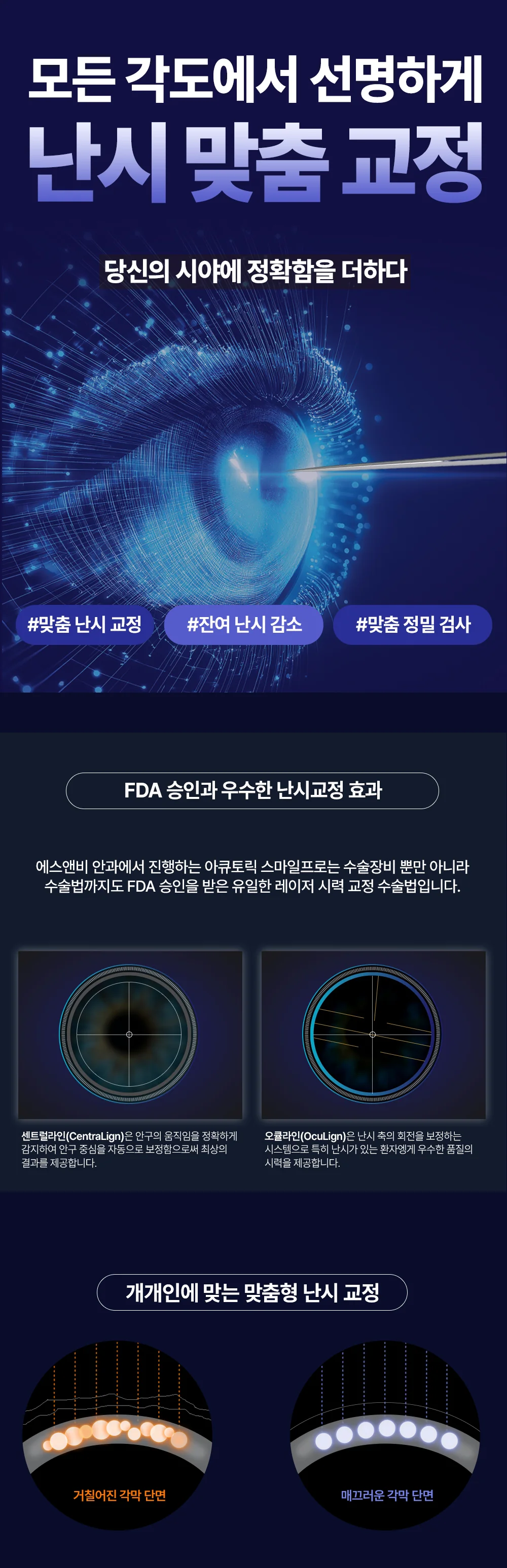 시력교정 상세 안내 첫 번째 부분