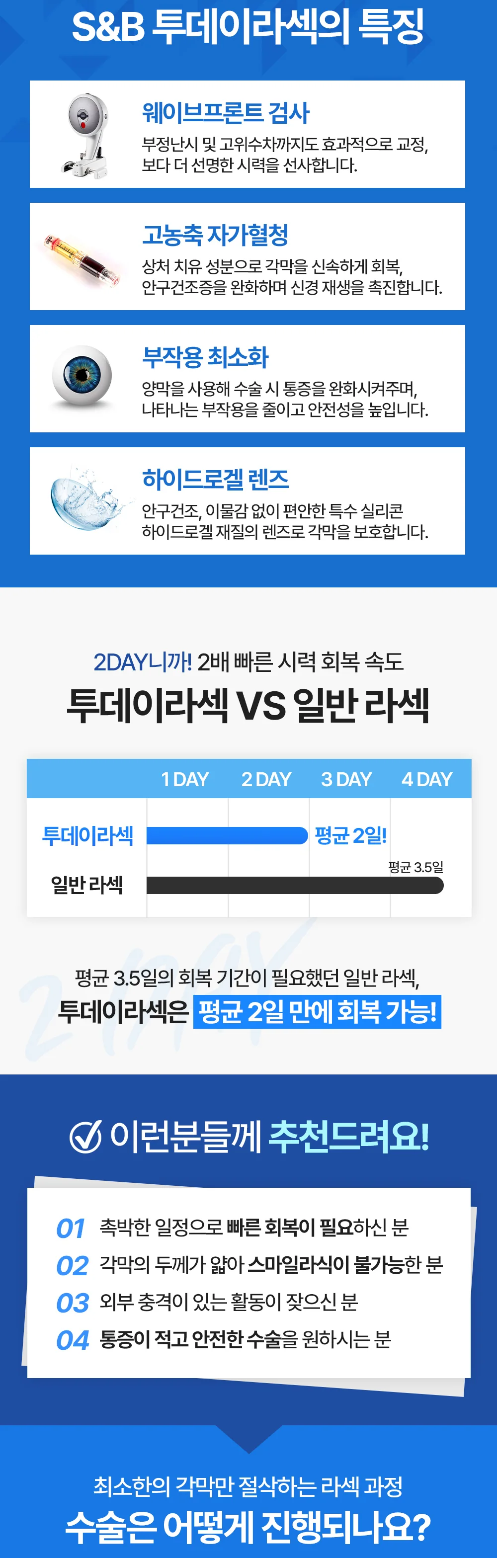 시력교정 상세 안내 네 번째 부분