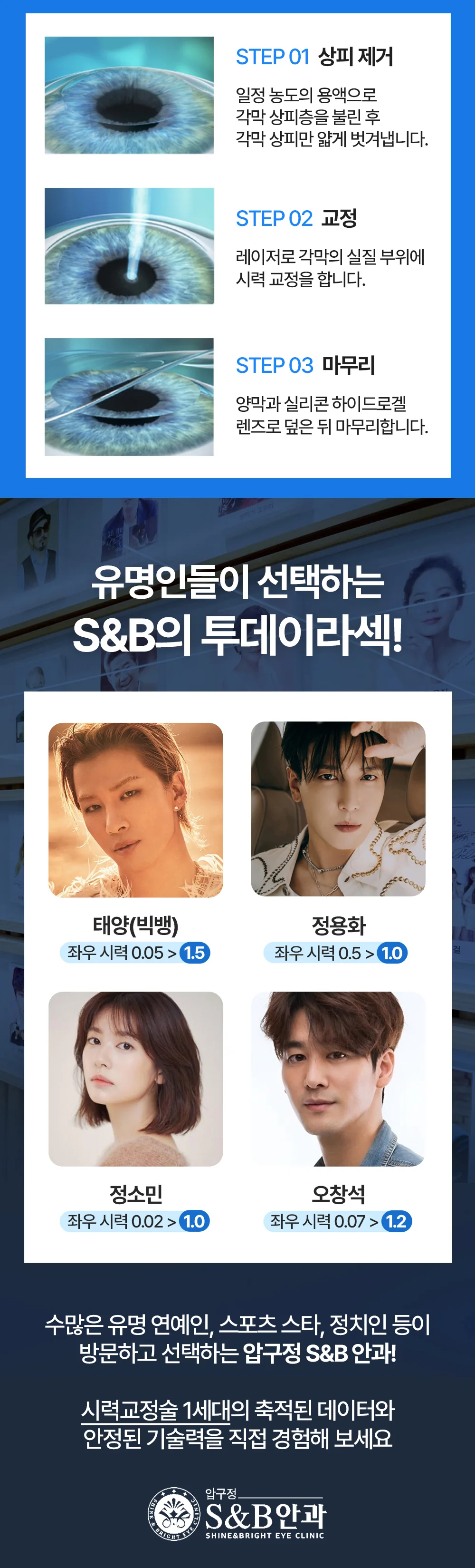 시력교정 상세 안내 다섯 번째 부분